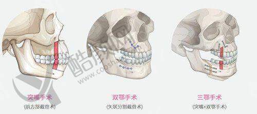 新疆喀什昕整医疗美容医院的口碑评价