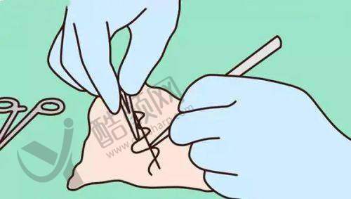 重庆美仑美奂整形医院的擅长项目——胸下垂矫正