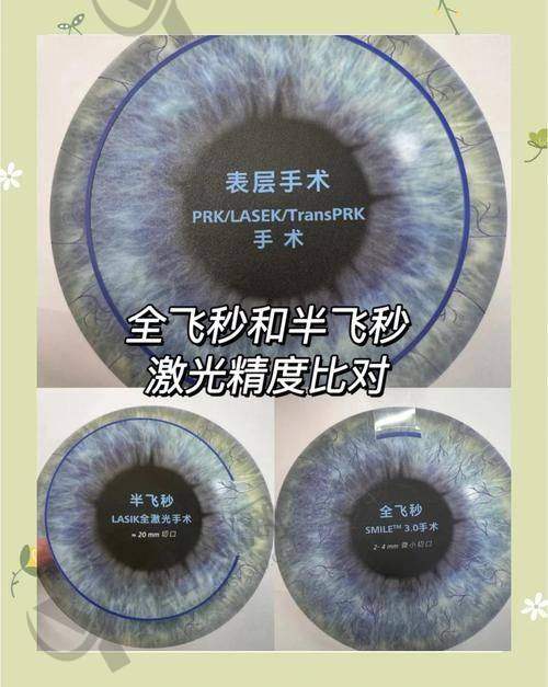 南宁爱尔眼科医院半飞秒手术真实评价