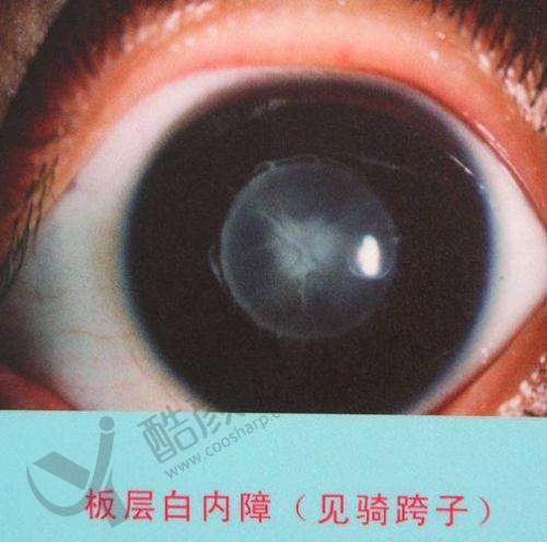 南宁爱尔眼科医院的地址和路线