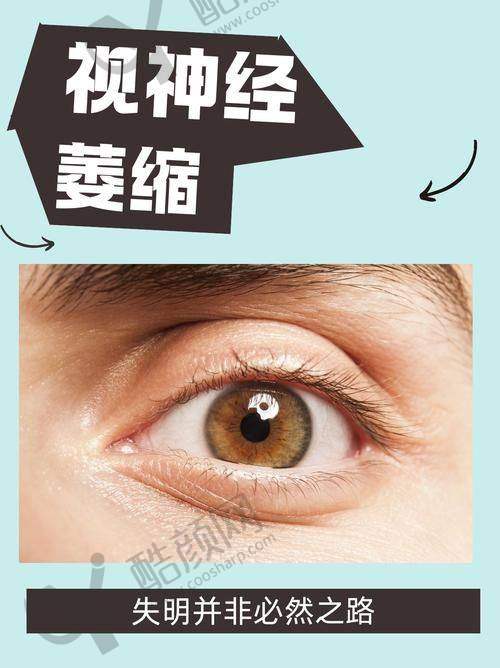 同仁眼科魏文斌医生的真实的患者评价如下：