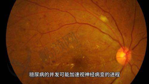 同仁眼科魏文斌医生擅长的项目怎么样？