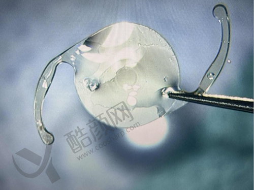 北京民众眼科王建英医生做单焦点人工晶体植入手术5500元起，设备新服务优！ 