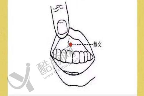 义乌正规整形医院有哪些？连天美、柠栎等6家医院资质好项目多价格合理