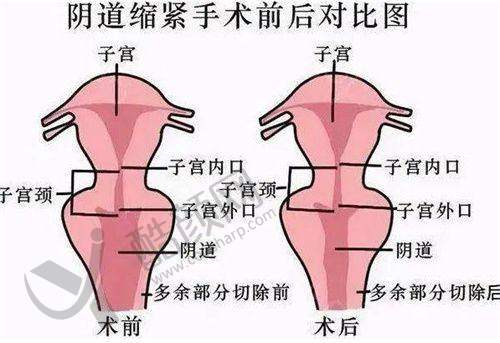 五、新疆喀什昕整医疗美容门诊部怎么预约：