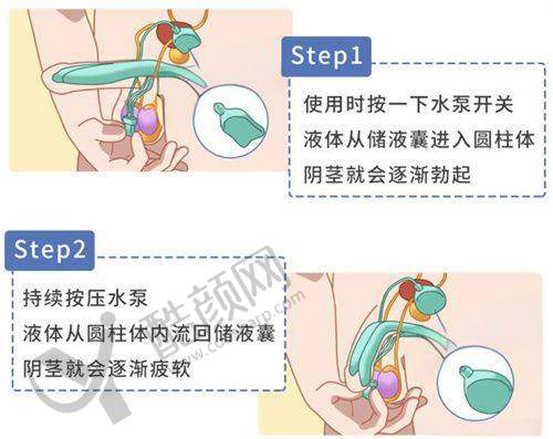 中山市人民医院光子嫩肤：选择与建议