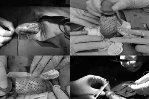 台州薇阁医疗美容:老牌韩系风格,技术有特色