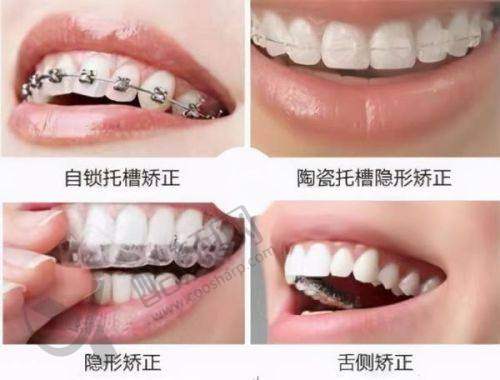 根管治疗并非万能