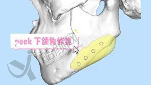 一、郑州缔莱美医疗美容医院怎么样？