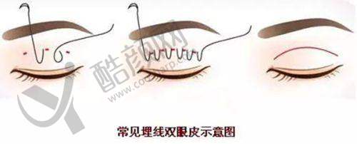 李俊霞医生:口碑评价与价格