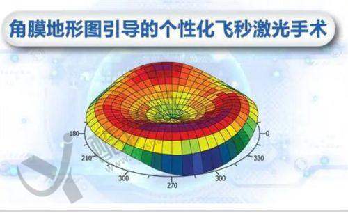 半飞秒修复期后能获得怎样的成效？