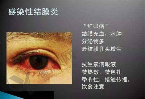 一、阜阳泽明眼视光眼科医院怎么样?