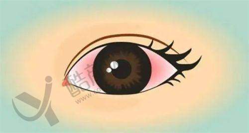 五、阜阳泽明眼视光眼科医院怎么预约: