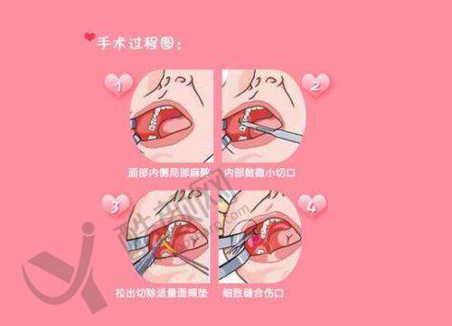 李俊霞医生:擅长项目全知道
