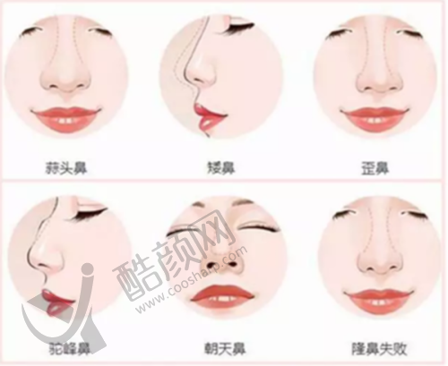 西宁美莱馨怡整形美容医院开展的项目
