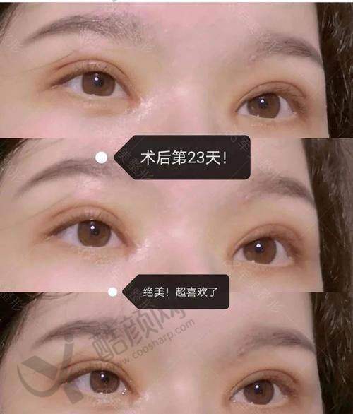 郑小红医生成功实例
