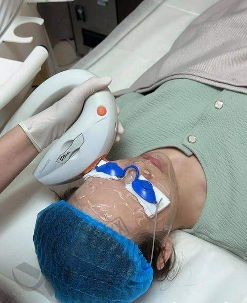 长沙雅美医院光子嫩肤950元起，皮秒+光子分层治斑，术后冷喷修复超贴心 
