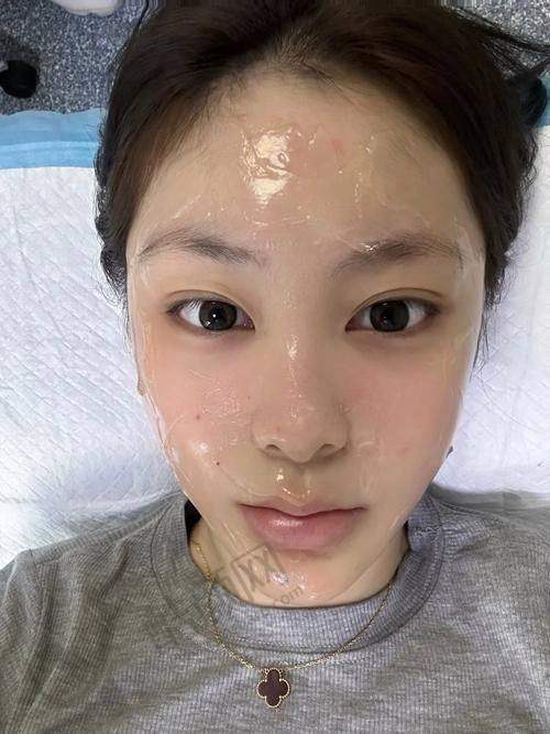长沙雅美皮秒+光子分层治斑优势