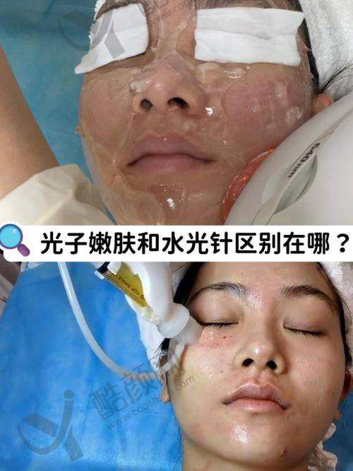 长沙雅美术后冷喷修复贴心服务