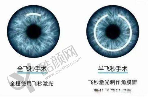 聊城爱尔眼科医院信息大揭秘