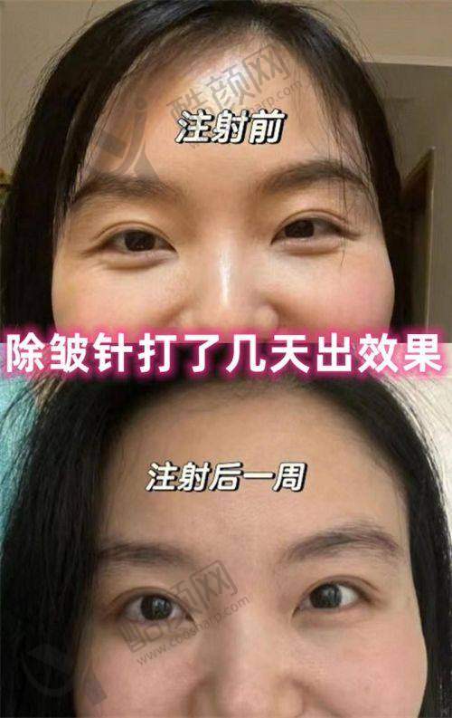南京美莱整形医院的优点