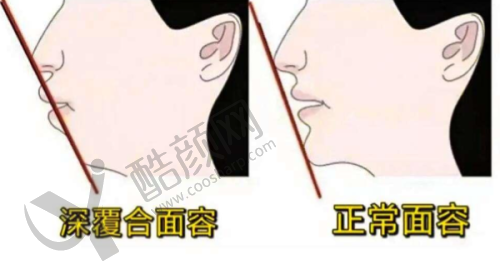 常熟一院种植牙价格详情