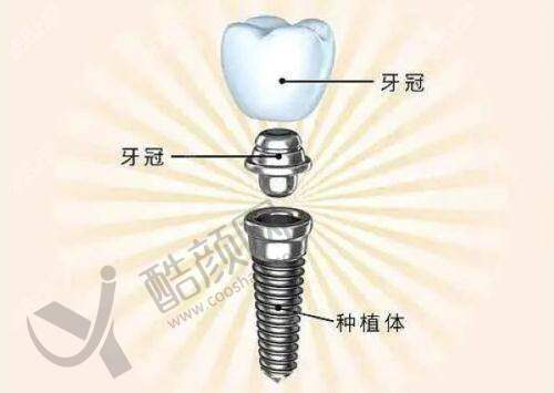 日照柏瑞口腔门诊部的价格优势