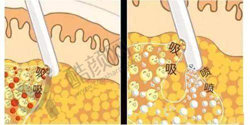 六、广州丽合医疗美容医院价格表:(仅供参考)