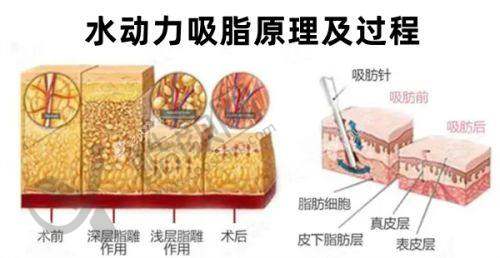 五、济南丽合医疗美容医院价格表：（仅供参考）