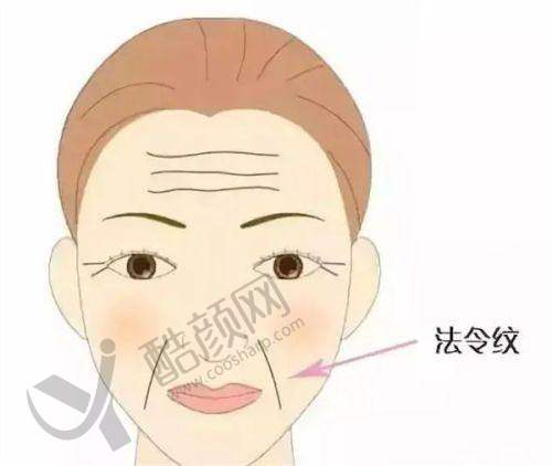 重庆松山医院肖林颧骨整形真实评价