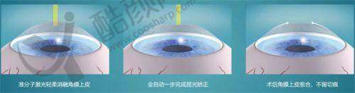 恩施慧宜眼科医院优质服务保视力防控