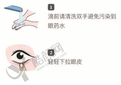 河南省人民医院庞辰久手术费用与预约方式
