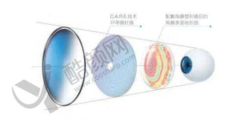 恩施慧宜眼科医院配镜价格优势