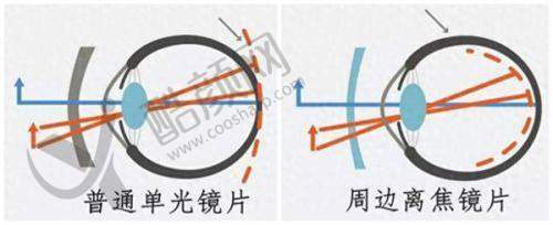 河南省人民医院庞辰久擅长项目与技术特点