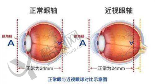 北京同仁眼科医院24小时在线资讯之线上问诊贴心