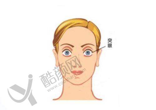 重庆爱尔眼科医院白内障手术的真实评价