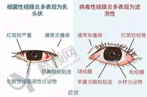 恩施慧宜眼科医院配镜价格实惠