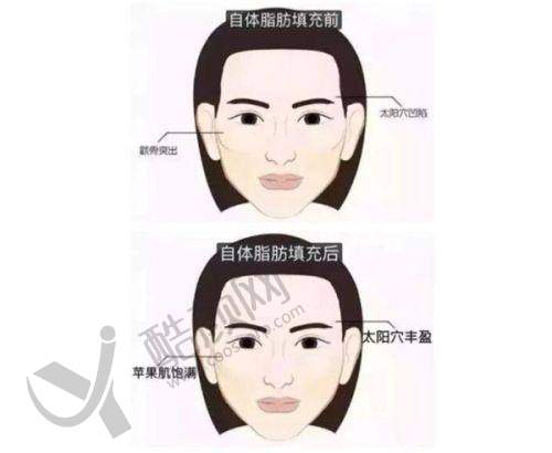 百色华美整形成功实例与口碑评价
