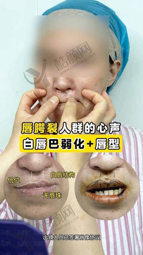 重庆松山医院夏德林医生介绍