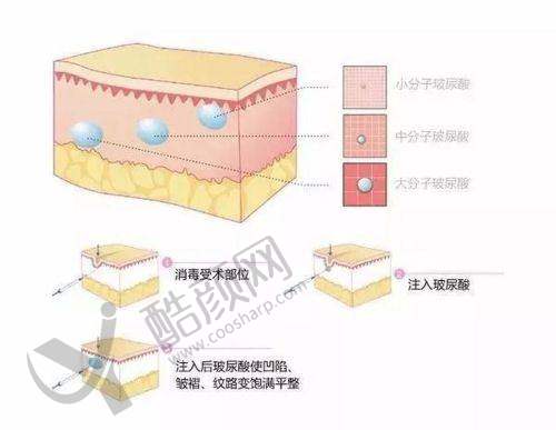 杭州艺星李俊霞医生简介