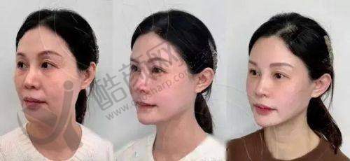 上海薇琳医疗美容卜双燕医生简介