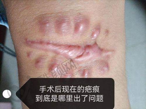 武汉正璞刘婷医生实力揭秘
