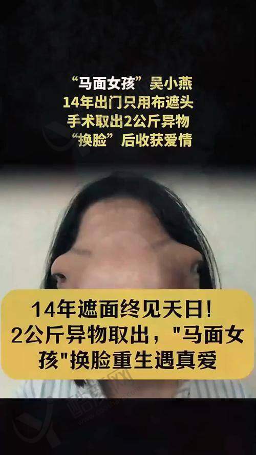 吴贞跃医生口碑评价：患者高度认可