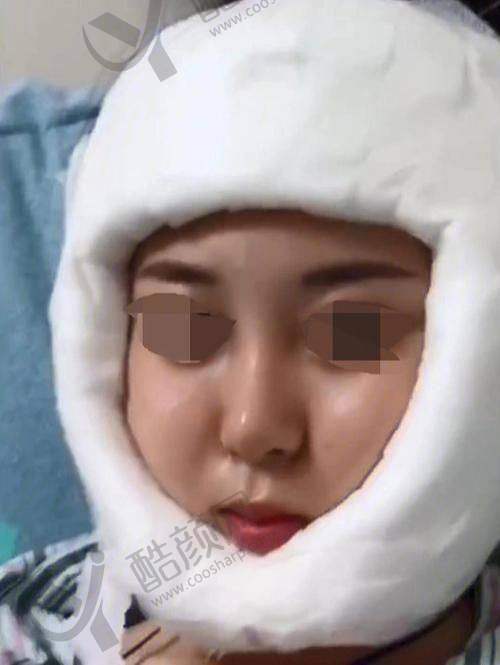 何照华——追求韩系风格的磨骨骨干医生