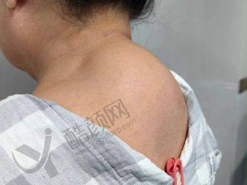 广州美莱医疗美容：精细治疗，降低复发率