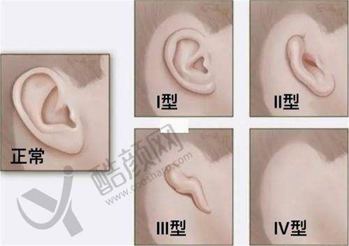 西安画美医院开展项目及价格