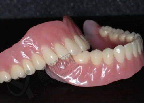 麦芽口腔和格伦菲尔口腔的价格对比