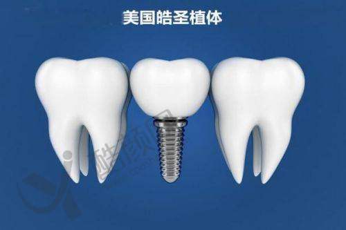 北京馨关口腔诊所种牙特色