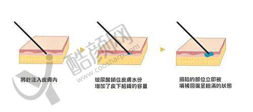 常德丽星整形美容的成功实例