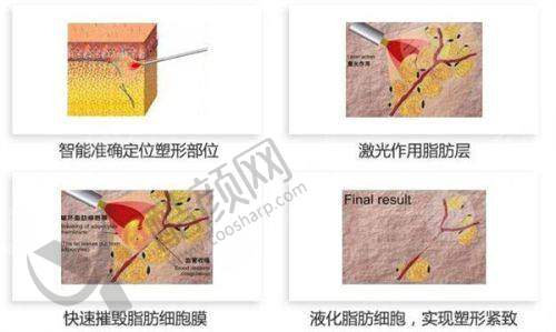 广州曙光医学美容医院:3D模拟技术一绝